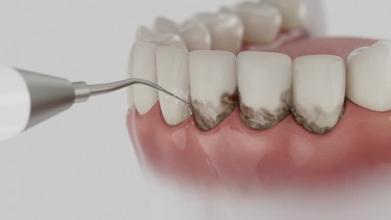 Trusted Tooth Extraction service in Laguna Vista, TX - Dentist Open Now